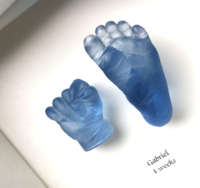 Foot cast example resin