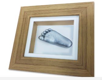 Foot cast example 2